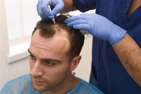 hermes turkey online shopping|best clinic hair transplant turkey.